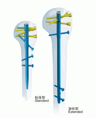 Ноготь хирургического Humerus Orthopedics анатомического блокируя