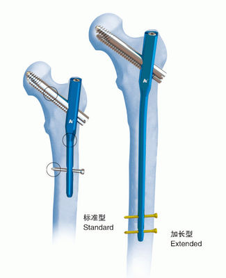 Ноготь PFN гаммы титана OrthopedicsⅣ блокируя