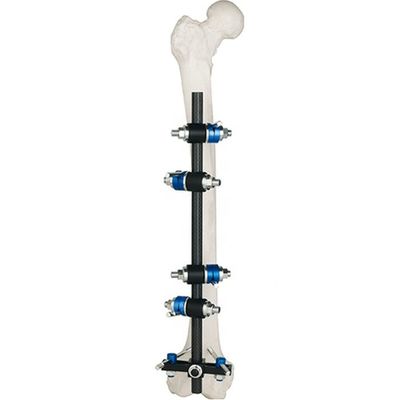 Бедренная кость большеберцовое внешнее Fixator