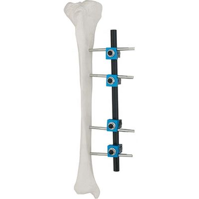 Продукт	REF	Спецификация	Qty. Condylar внешнее Fixator 8100-06	8100-0601	Штанг-штанга соединяя Ø8/8mm	3 8100-0602	Pin-R