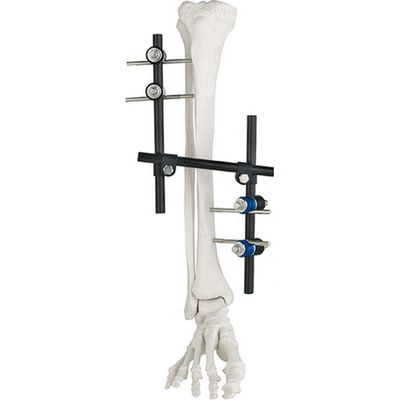 Продукт	REF	Спецификация	Qty. Condylar внешнее Fixator 8100-06	8100-0601	Штанг-штанга соединяя Ø8/8mm	3 8100-0602	Pin-R