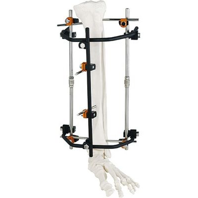 Продукт	REF	Спецификация	Qty. Condylar внешнее Fixator 8100-06	8100-0601	Штанг-штанга соединяя Ø8/8mm	3 8100-0602	Pin-R