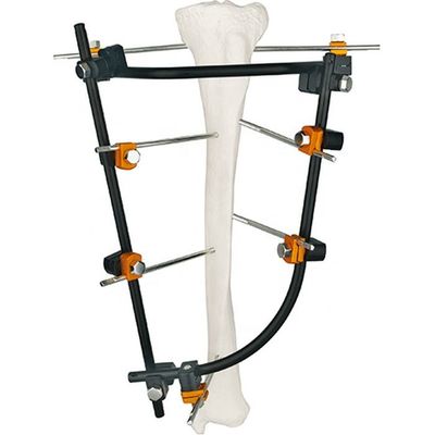 Продукт	REF	Спецификация	Qty. Condylar внешнее Fixator 8100-06	8100-0601	Штанг-штанга соединяя Ø8/8mm	3 8100-0602	Pin-R